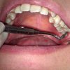 歯フェチ！本物歯科治療映像 井野紅葉