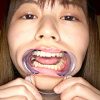 園田かのこチャンの初めての歯・口内・舌ベロ唾観察