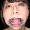 優木なおチャンの銀歯だらけの激レア歯・口内観察！！！