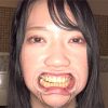 超・超・超貴重な口内・銀歯・のどちんこ観察！葉月英里