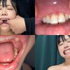 よだれダラダラすずちゃんの口内観察